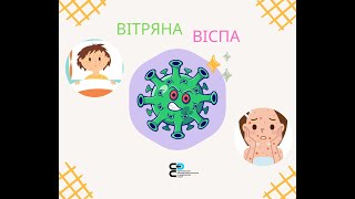 Вітряна віспа. Симптоми та наслідки інфекційного захворювання розповідає лікар Левчак Л. В