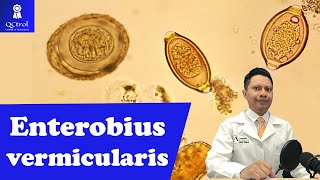 Знакомьтесь, Enterobius vermcularis (острицы): тест Грэма и взрослые особи🔬