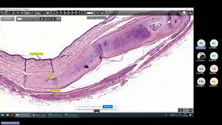 Histo 11 October BE 2567