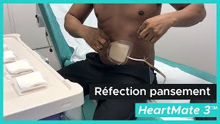 Réfection du pansement par le patient - HeartMate 3™