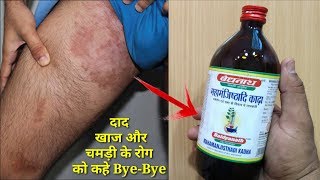 Cure Ringworm, Eczema, Psoriasis, skin disorder | My Healthy India