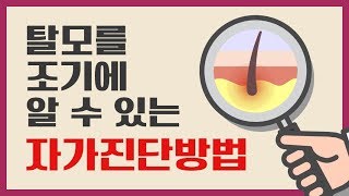 탈모를 조기에 알 수 있는 자가진단방법은?