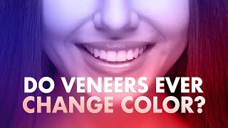 Do veneers ever change color?