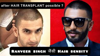 Is Ranveer Singh hair density possible with HAIR TRANSPLANT?|HairFall|MINOXIDIL|FINASTERIDE|results|