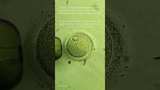 Stages of intracytoplasmic sperm injection into the oocyte (ICSI). #ivf #embrio #art #oocyte #sperm