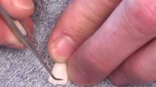 Maxilary Central Incisor carving.clip4.mov