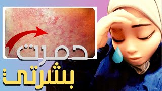 جربت ٥ منتجات للبشرة ترند و بشرتي اتدمرت | تعالو شوفو الي حصل