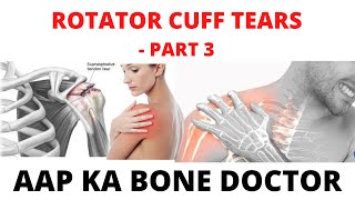 ROTATOR CUFF TEARS - PART 3 - EPISODE 3