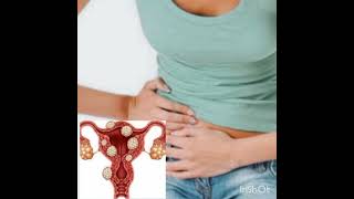 Endometrioza-lećenje po receptu časne setre-Endometriosis recipe  @ZdravUmTeloDusa