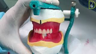 Dentiscope | Arranging Upper and Lower Anterior Teeth