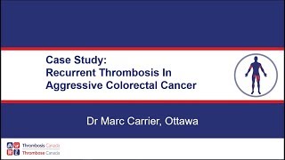 Recurrent Thrombosis in Aggressive Colorectal Cancer - Case Study