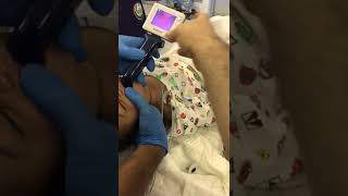 anesthesia video laryngosocpe