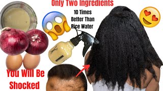 No Joke! Overnight  Hair Growth Treatment ! How To Stop My Hair From Falling! 100% Results!