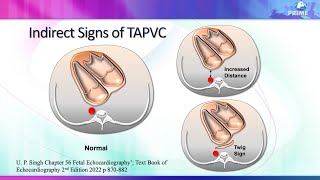 Fetal Echo for adult cardiologists part 1