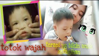 Terapi Oromotorik anak down syndrome - dengan cara Pijat wajah dan Menggunakan sikat