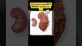 Kidney Failure Symptoms | Healthy Bharat | Dr Abhiinav Chaturvedii | #shorts