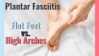 Plantar Fasciitis | Flat Feet vs. High Arch