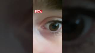 I’m one of the 8% :3 #fypシ゚viral #eyes #eye #foryou #fypeyes #rare