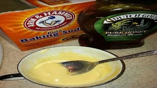 Baking Soda And Honey: Remedy That Destroys Even The Most Severe Disease