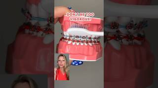 HOW to BRUSH with BRACES ON? *avoid the WHITE STAINS #braces #toothbrush #education