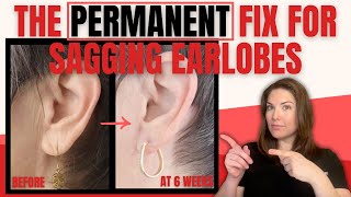 Say Goodbye to Droopy, Stretched Out Earring Holes Forever