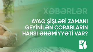 Ayaq şişləri zamanı geyinilən corabların hansı əhəmiyyəti var?