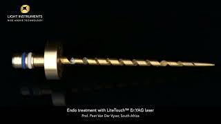 Endo treatment with LiteTouch™ Er:YAG laser