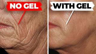 The World's #1 NIGHTLY Anti-Wrinkle Gel Is Stupidly Cheap