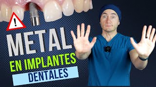 El metal en los implantes dentales te puede dañar mucho