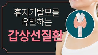 휴지기 탈모를 유발하는 원인 갑상선 질환 / 갑상선 기능 저하증과 갑상선 기능 항진증으로 인한 탈모진행 양상