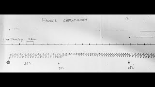 Frog’s Cardiogram & Effect of Temperature