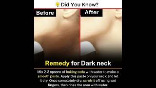 Remedy for dark neck!!! 👍 #remedies #darknecktreatment #makeup