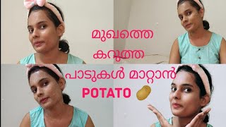 മുഖത്തെ കറുത്ത പാടുകൾ മാറ്റാൻ Potato🥔Easy Potato facial at home 💯#1k #trending #subscribe #viral