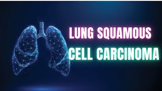 What is Lung Squamous Cell Carcinoma? Overview and Insights  | Dr Academy