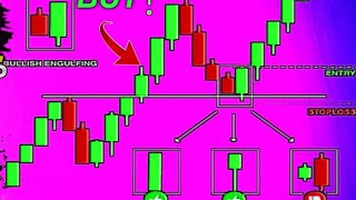 Today Xau/Usd Gold Analysis And Mapping Perfect Entry Zone।