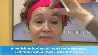 Botox en Centre Medic Meisa