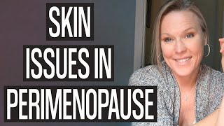 Skin Issues in Perimenopause: BEST ingredients and Products for Collagen Boosting, Acne, and More!