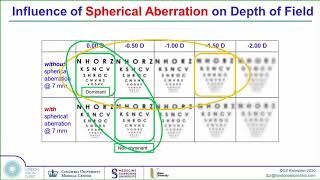 Treatment of Presbyopia (reading vision) by LASIK - Professor Dan Reinstein American Academy Lecture