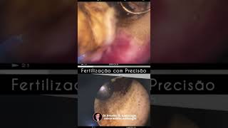 Fertilização com Precisão - IPGO - Dr. Arnaldo Cambiaghi