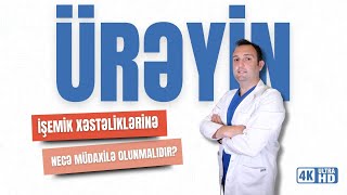 Ürəyin işemik xəstəliklərinə necə müdaxilə edilməlidir? Koronar şuntlama əməliyyatı nədir?