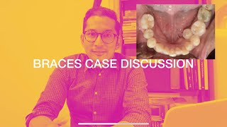 BRACES CASE DISCUSSION