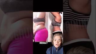 Real life examples of hormonal belly transformations 🤯