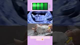 😀🔍 From Womb to World: Ultrasound vs. Reality 🌐 #newborn #shorts #viralvideo