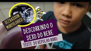 DESCOBRINDO O SEXO DO BEBÊ - TESTE CASEIRO E ULTRASSON MORFOLOGICO