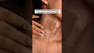 Neck Cleaning Tips | Dark Neck Home Remedies/Tanning Removal Tips #skincare#shorts#viral #beauty