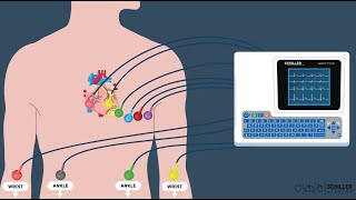 SCHILLER ECG: Principes de base de l'électrocardiogramme