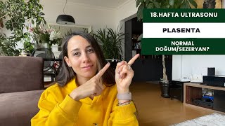 Hamilelikte 18.Hafta | Turşu ile Tanışın | Plasentayı Yemek? | Placenta Previa