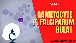 GAMETOCYTE PLASMODIUM FALSIPARUM BULAT