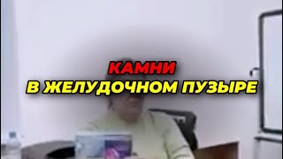 Избавилась от камней в желчном пузыре принимая активный коралловый кальций и коэнзим QH от BELEEVER