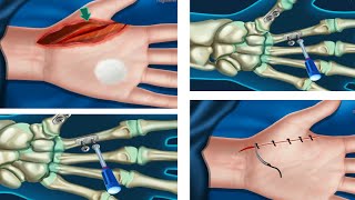 Asmr hand bone cracked and how to fix it #mrnajeebideas